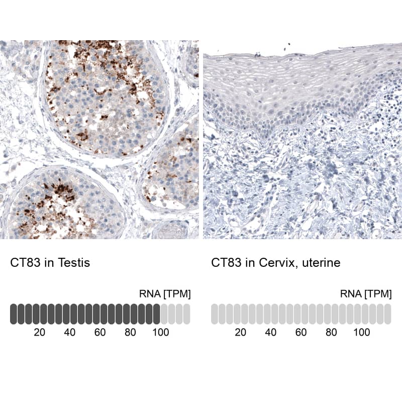 CT83 Antibody (CL4762) Immunohistochemistry: CT83 Antibody (CL4762) [NBP3-52075]