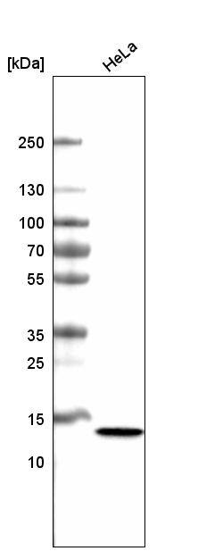 CT83 Antibody (CL4762) Western Blot: CT83 Antibody (CL4762) [NBP3-52075]