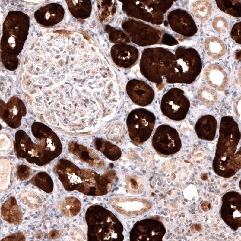 Dopa Decarboxylase/DDC Antibody (CL2962) Immunohistochemistry: Dopa Decarboxylase/DDC Antibody (CL2962) [NBP3-52076]