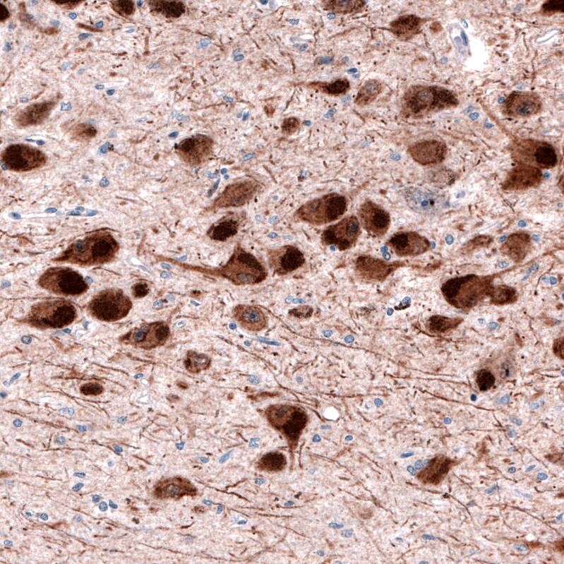 Dopa Decarboxylase/DDC Antibody (CL2962) Immunohistochemistry: Dopa Decarboxylase/DDC Antibody (CL2962) [NBP3-52076]