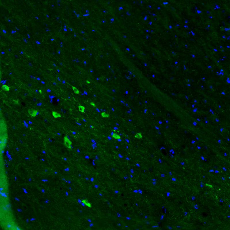 Dopa Decarboxylase/DDC Antibody (CL2962) Immunohistochemistry: Dopa Decarboxylase/DDC Antibody (CL2962) [NBP3-52076]