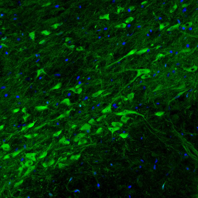 Dopa Decarboxylase/DDC Antibody (CL2962) Immunohistochemistry: Dopa Decarboxylase/DDC Antibody (CL2962) [NBP3-52076]