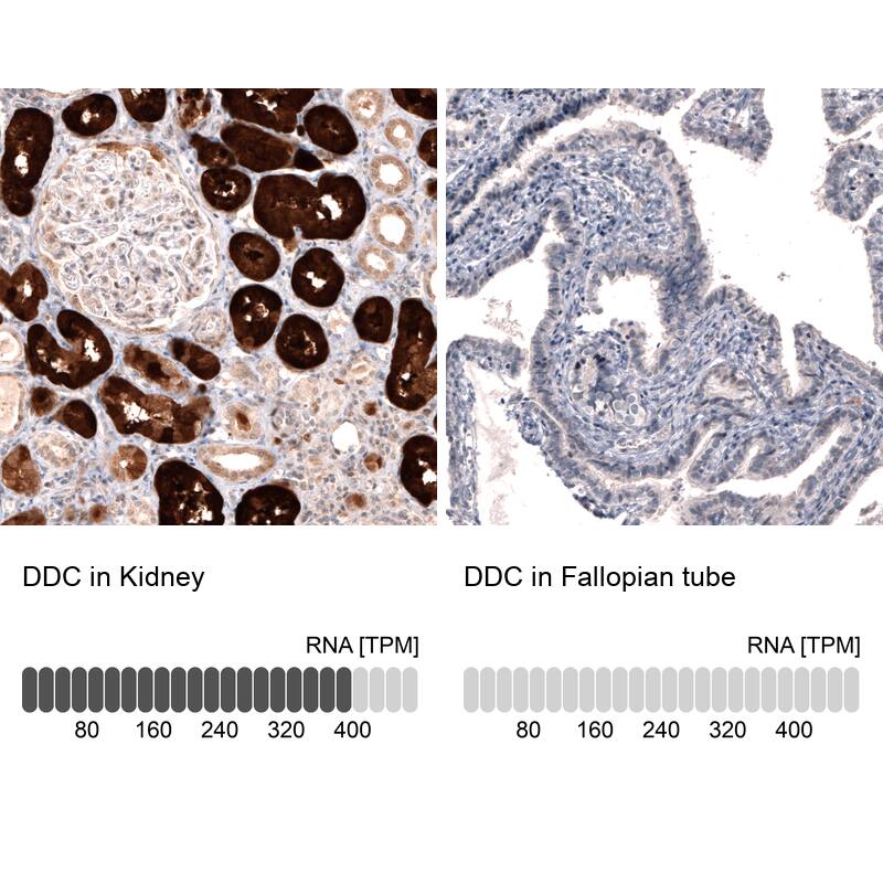 Dopa Decarboxylase/DDC Antibody (CL2962) Immunohistochemistry: Dopa Decarboxylase/DDC Antibody (CL2962) [NBP3-52076]