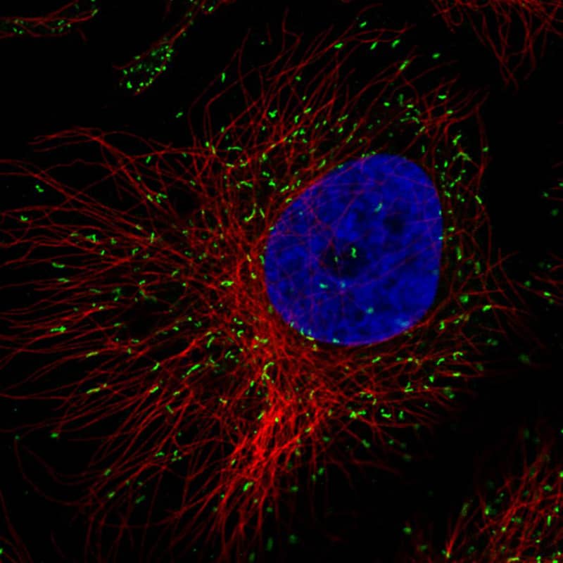 PMP70 Antibody (CL2524) Immunocytochemistry/ Immunofluorescence: PMP70 Antibody (CL2524) [NBP3-52459]