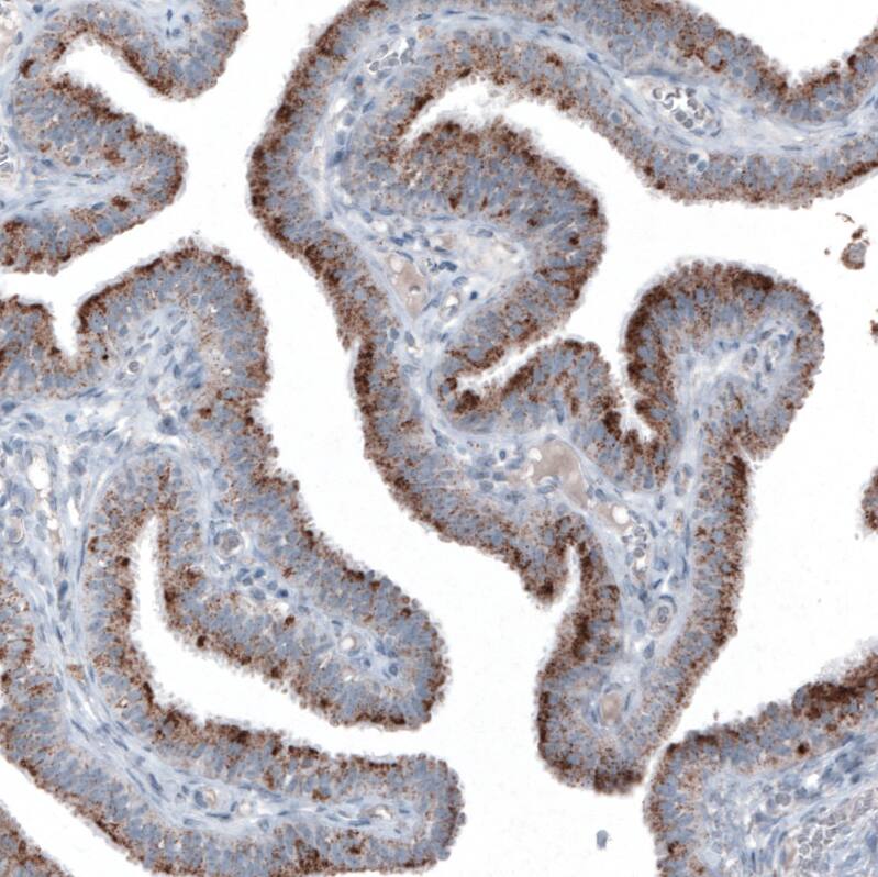 PMP70 Antibody (CL2524) Immunohistochemistry: PMP70 Antibody (CL2524) [NBP3-52459]