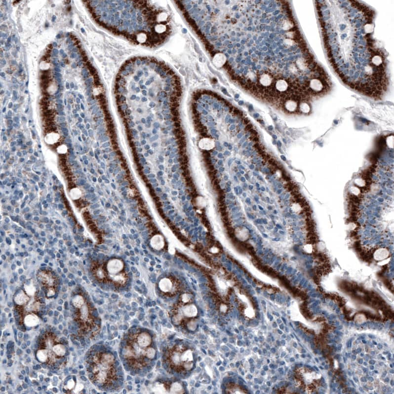 PMP70 Antibody (CL2524) Immunohistochemistry: PMP70 Antibody (CL2524) [NBP3-52459]