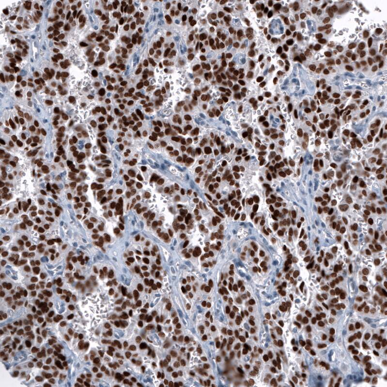 OTP Antibody (CL11225) Immunohistochemistry: OTP Antibody (CL11225) [NBP3-52078]