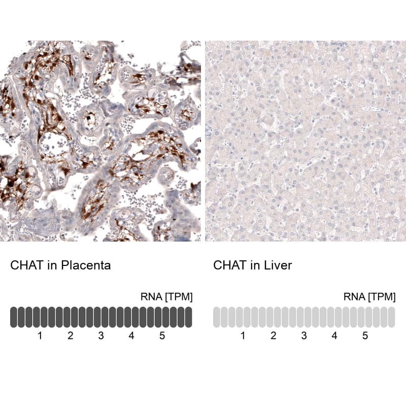 Choline Acetyltransferase/ChAT Antibody (CL3173) Immunohistochemistry: Choline Acetyltransferase/ChAT Antibody (CL3173) [NBP3-52079]