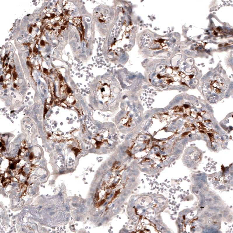 Choline Acetyltransferase/ChAT Antibody (CL3173) Immunohistochemistry: Choline Acetyltransferase/ChAT Antibody (CL3173) [NBP3-52079]
