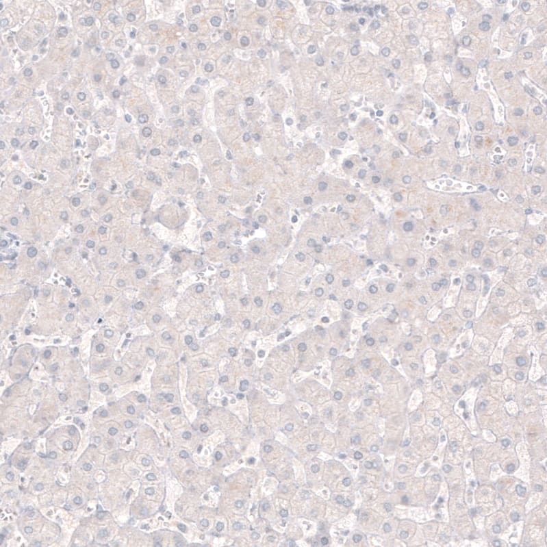 Choline Acetyltransferase/ChAT Antibody (CL3173) Immunohistochemistry: Choline Acetyltransferase/ChAT Antibody (CL3173) [NBP3-52079]