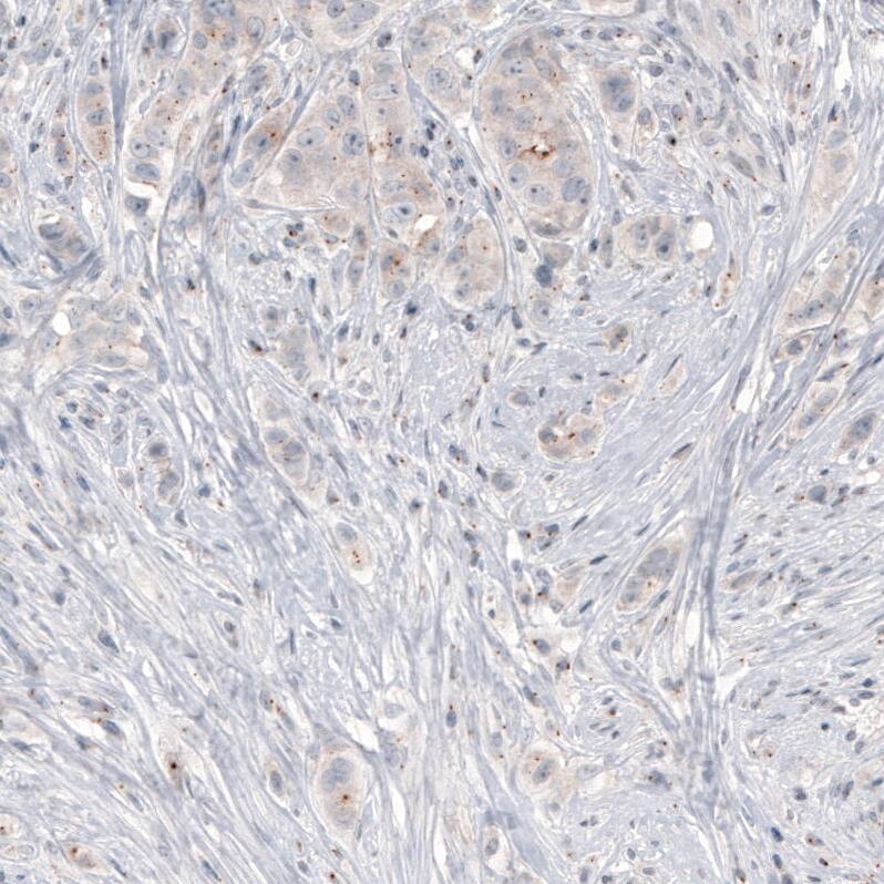 CEP350 Antibody (CL3423) Immunohistochemistry: CEP350 Antibody (CL3423) [NBP3-52080]