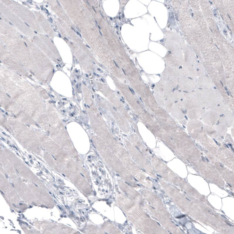 CEP350 Antibody (CL3423) Immunohistochemistry: CEP350 Antibody (CL3423) [NBP3-52080]