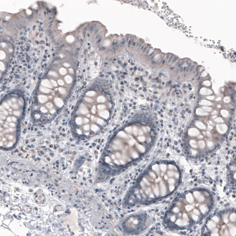 CEP350 Antibody (CL3423) Immunohistochemistry: CEP350 Antibody (CL3423) [NBP3-52080]