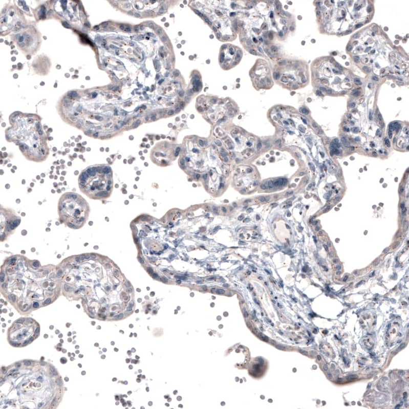 CEP350 Antibody (CL3423) Immunohistochemistry: CEP350 Antibody (CL3423) [NBP3-52080]