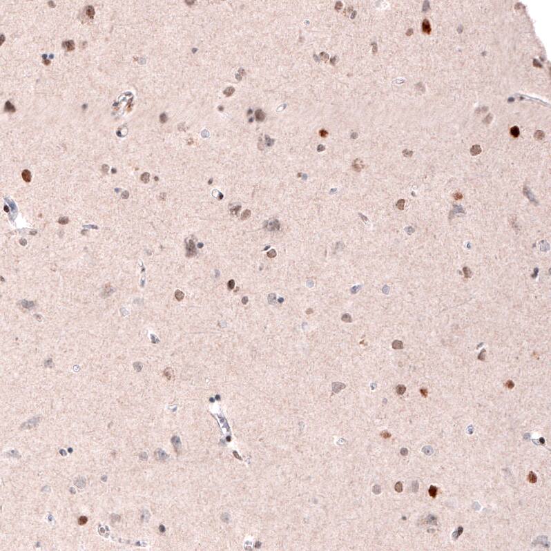 CDP/CUTL1 Antibody (CL5278) Immunohistochemistry: CDP/CUTL1 Antibody (CL5278) [NBP3-52081]