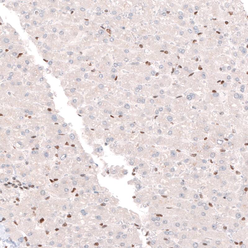 CDP/CUTL1 Antibody (CL5278) Immunohistochemistry: CDP/CUTL1 Antibody (CL5278) [NBP3-52081]