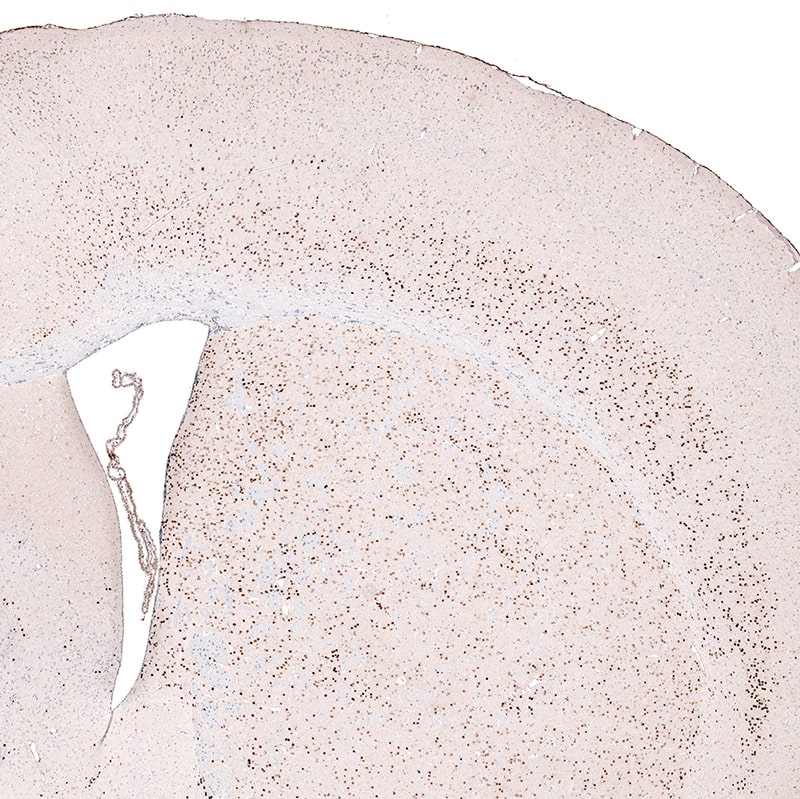 FoxP2 Antibody (CL5312) Immunohistochemistry: FoxP2 Antibody (CL5312) [NBP3-52082]