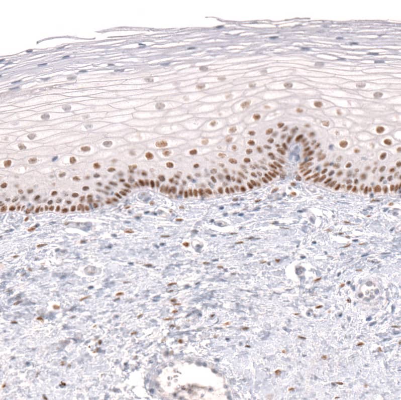 FoxP2 Antibody (CL5312) Immunohistochemistry: FoxP2 Antibody (CL5312) [NBP3-52082]