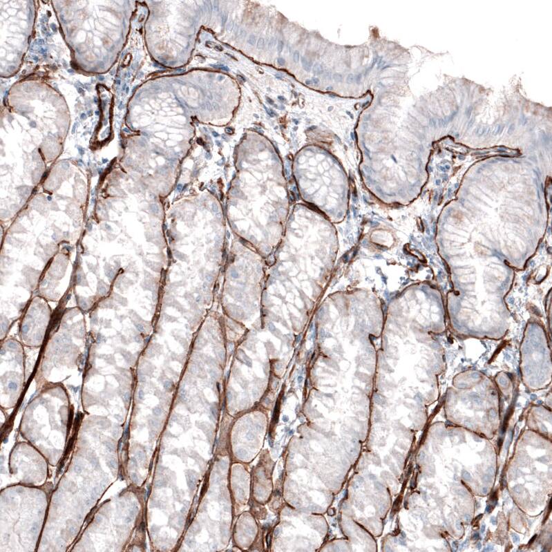 Laminin gamma 1 Antibody (CL3196) Immunohistochemistry: Laminin gamma 1 Antibody (CL3196) [NBP3-52084]