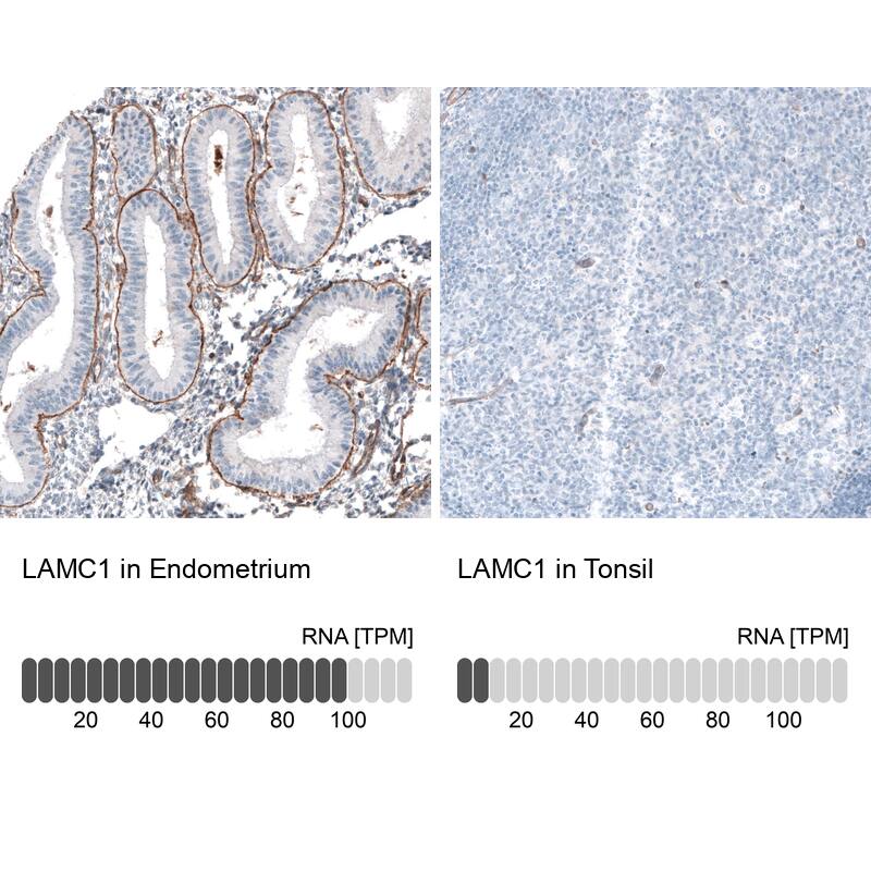 Laminin gamma 1 Antibody (CL3196) Immunohistochemistry: Laminin gamma 1 Antibody (CL3196) [NBP3-52084]