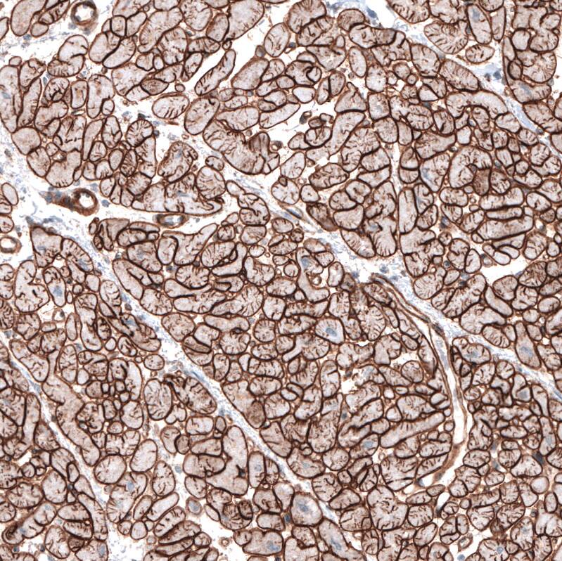 Laminin gamma 1 Antibody (CL3196) Immunohistochemistry: Laminin gamma 1 Antibody (CL3196) [NBP3-52084]