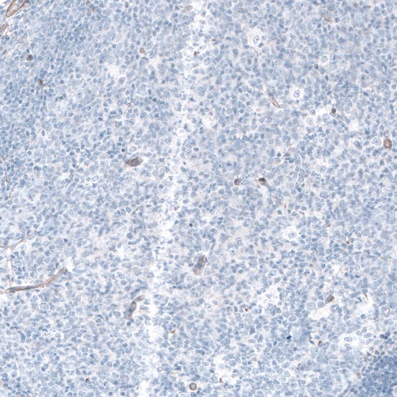 Laminin gamma 1 Antibody (CL3196) Immunohistochemistry: Laminin gamma 1 Antibody (CL3196) [NBP3-52084]