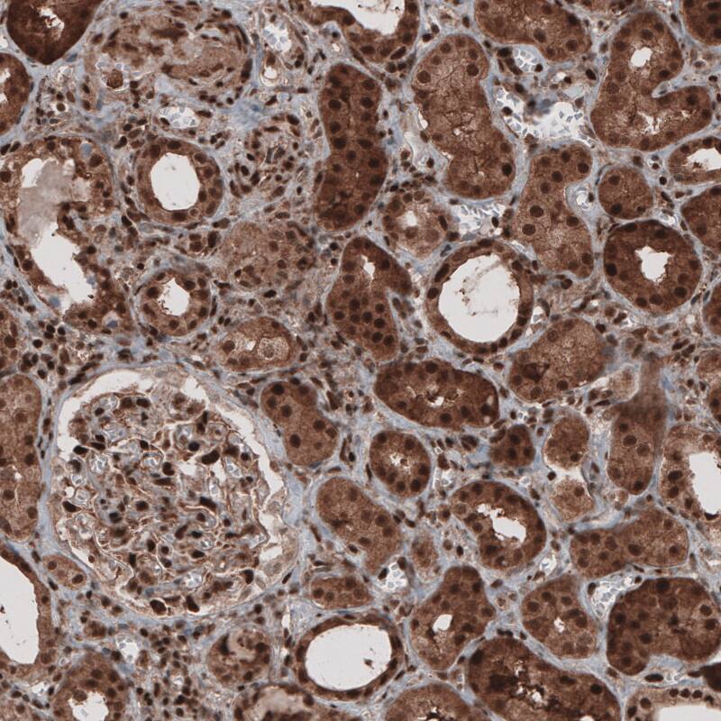 GAPDH Antibody (CL3265) Immunohistochemistry: GAPDH Antibody (CL3265) [NBP3-52086]