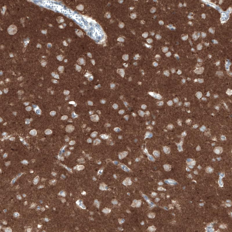 CD90/Thy1 Antibody (CL1028) Immunohistochemistry: CD90/Thy1 Antibody (CL1028) [NBP3-52087]