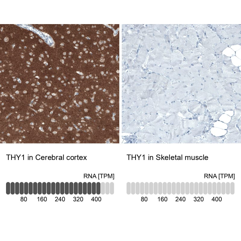 CD90/Thy1 Antibody (CL1028) Immunohistochemistry: CD90/Thy1 Antibody (CL1028) [NBP3-52087]