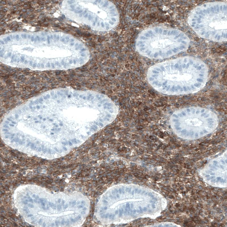 CD90/Thy1 Antibody (CL1028) Immunohistochemistry: CD90/Thy1 Antibody (CL1028) [NBP3-52087]