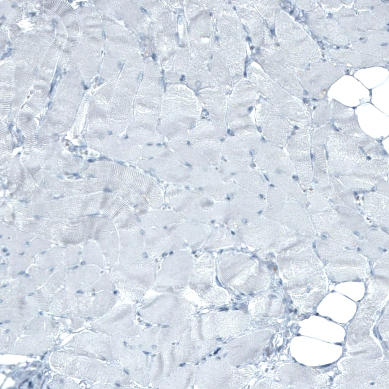 CD90/Thy1 Antibody (CL1028) Immunohistochemistry: CD90/Thy1 Antibody (CL1028) [NBP3-52087]