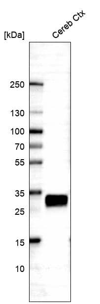 CD90/Thy1 Antibody (CL1028) Western Blot: CD90/Thy1 Antibody (CL1028) [NBP3-52087]