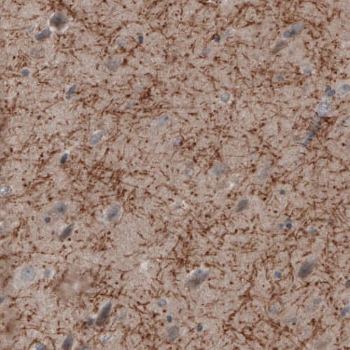 MOG Antibody (CL2852) Immunohistochemistry: MOG Antibody (CL2852) [NBP3-52089]