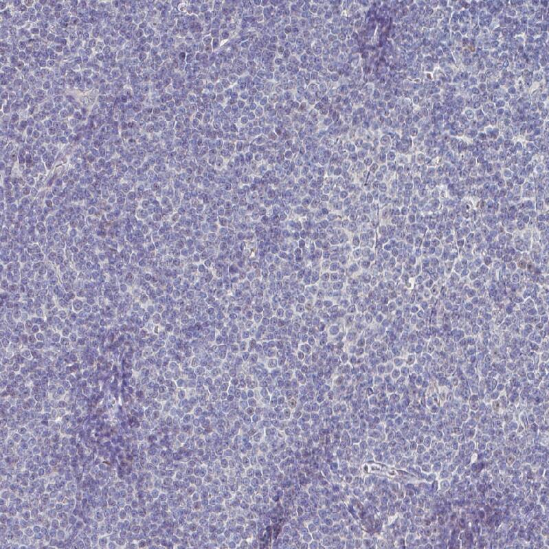SOX11 Antibody (CL0143) Immunohistochemistry: SOX11 Antibody (CL0143) [NBP3-52090]