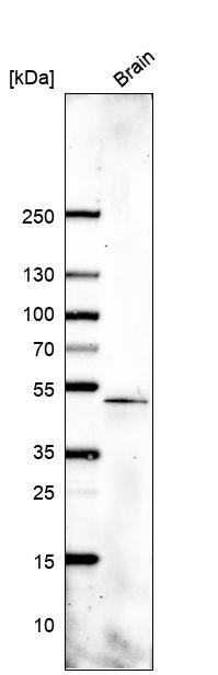 SOX11 Antibody (CL0143) Western Blot: SOX11 Antibody (CL0143) [NBP3-52090]