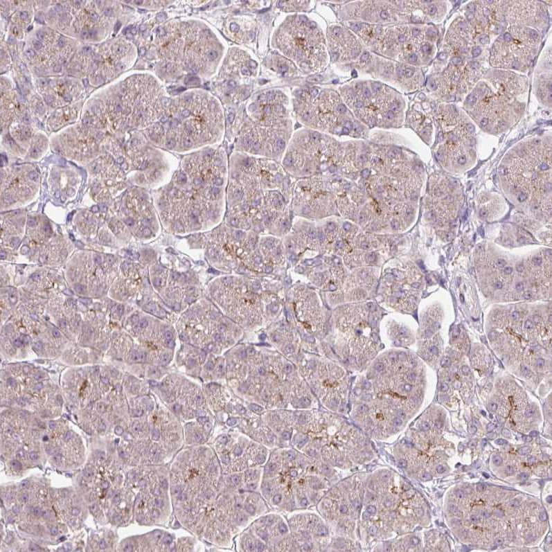PCM1 Antibody (CL0206) Immunohistochemistry: PCM1 Antibody (CL0206) [NBP3-52091]