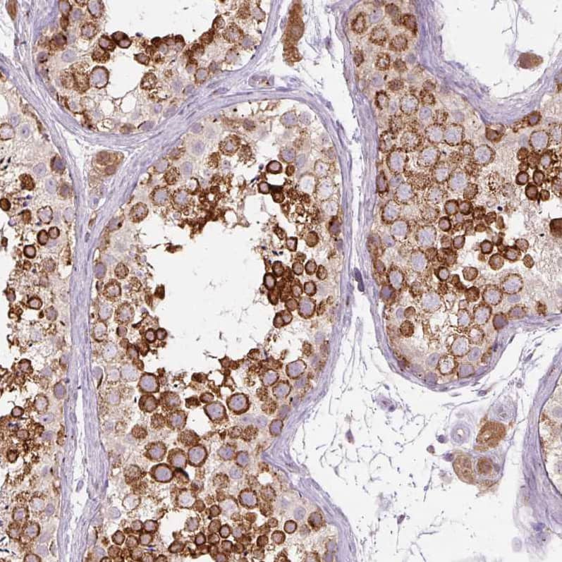 PCM1 Antibody (CL0206) Immunohistochemistry: PCM1 Antibody (CL0206) [NBP3-52091]