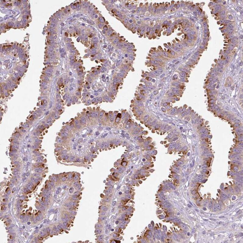 PCM1 Antibody (CL0206) Immunohistochemistry: PCM1 Antibody (CL0206) [NBP3-52091]