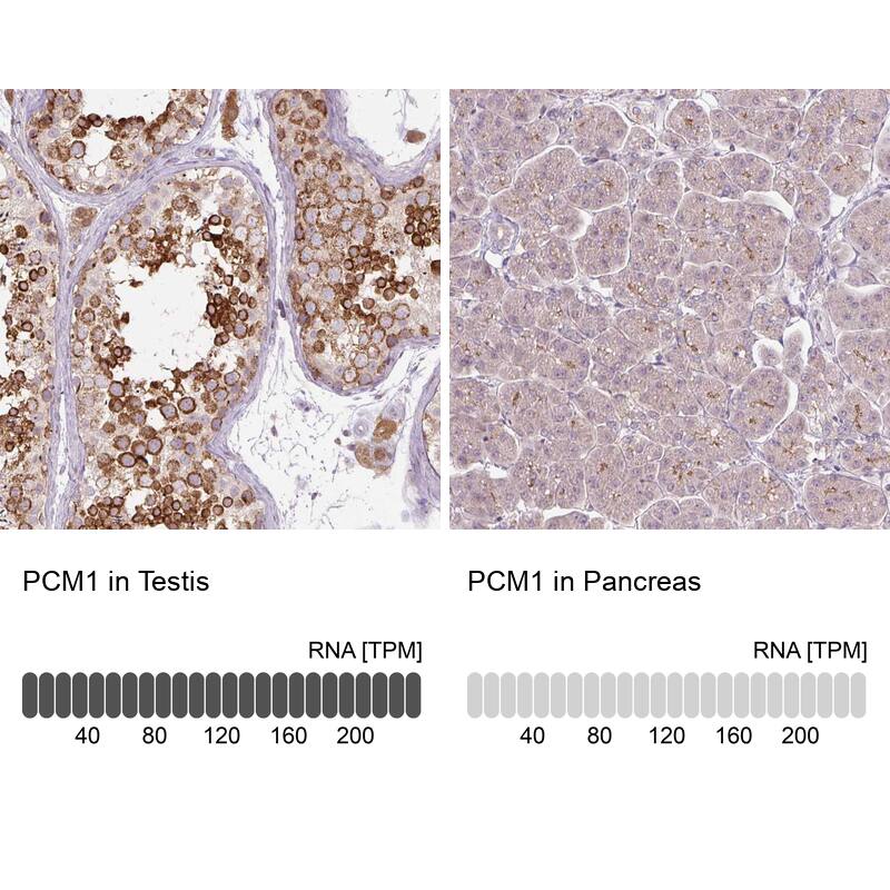 PCM1 Antibody (CL0206) Immunohistochemistry: PCM1 Antibody (CL0206) [NBP3-52091]