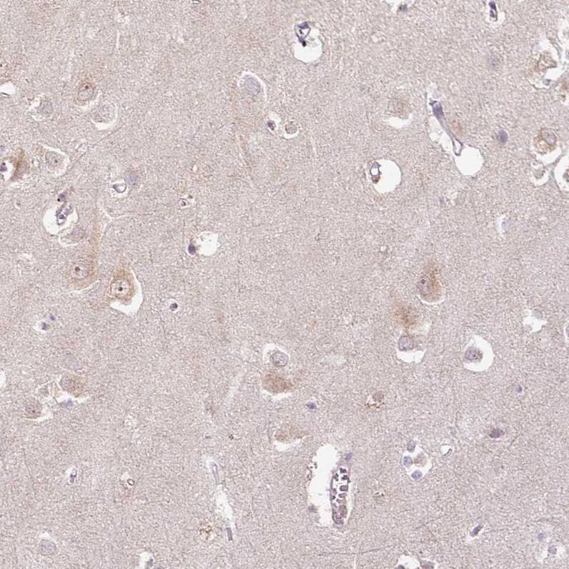PCM1 Antibody (CL0206) Immunohistochemistry: PCM1 Antibody (CL0206) [NBP3-52091]