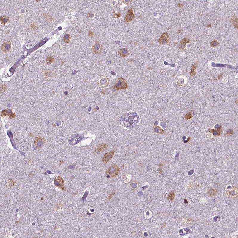 Dicer Antibody (CL0378) Immunohistochemistry: Dicer Antibody (CL0378) [NBP3-52092]