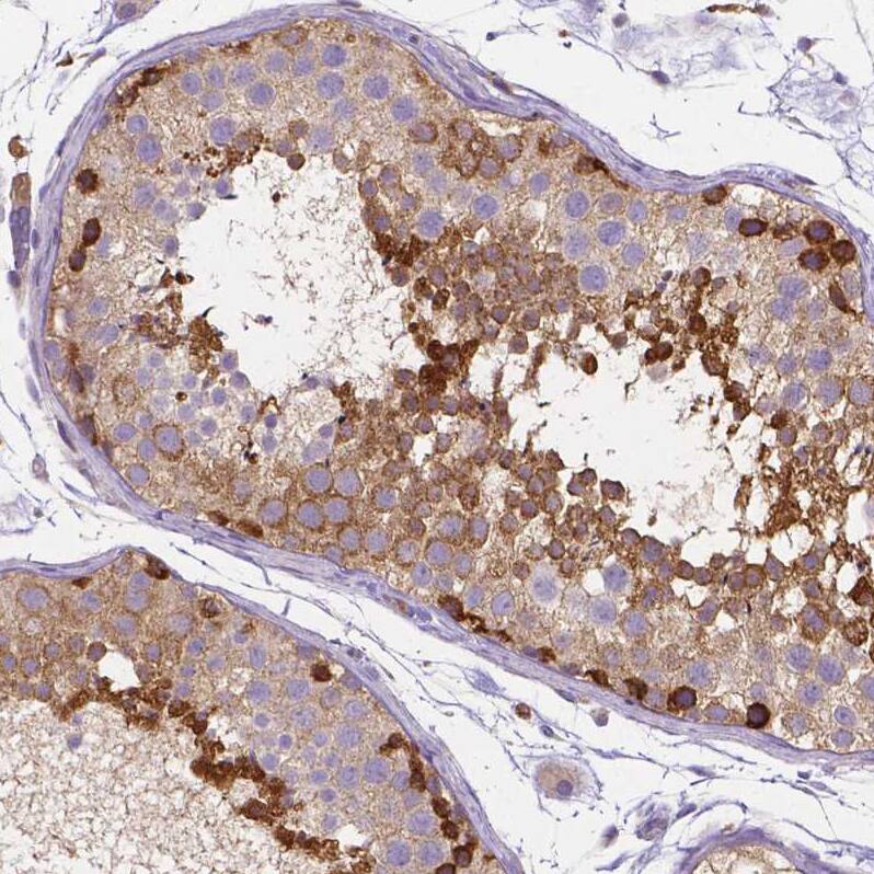 Dicer Antibody (CL0378) Immunohistochemistry: Dicer Antibody (CL0378) [NBP3-52092]