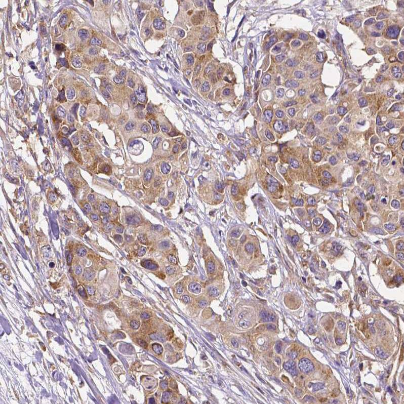 Dicer Antibody (CL0378) Immunohistochemistry: Dicer Antibody (CL0378) [NBP3-52092]