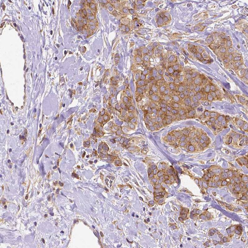 Dicer Antibody (CL0378) Immunohistochemistry: Dicer Antibody (CL0378) [NBP3-52092]