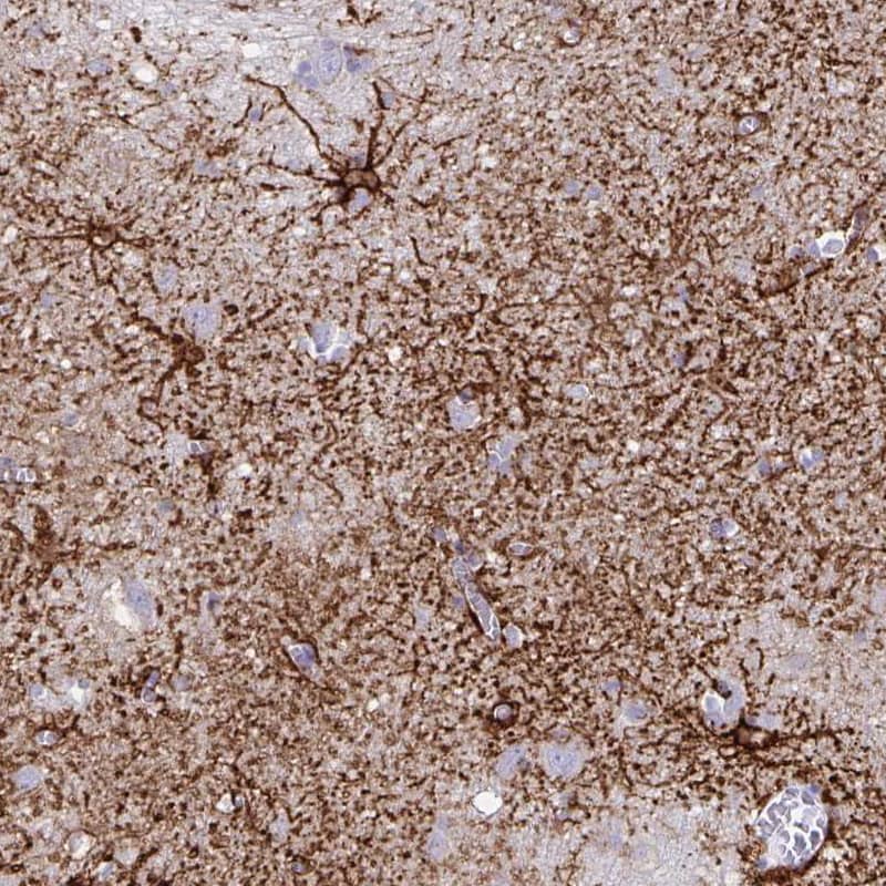 Immunohistochemistry: Aquaporin-4 Antibody (CL0178) [NBP3-52095]