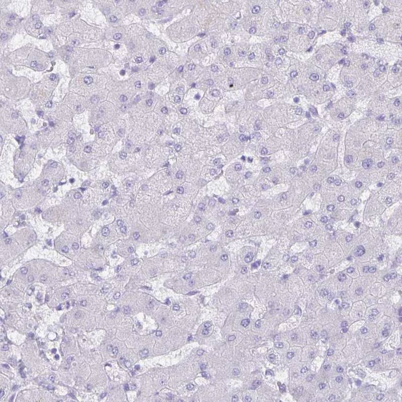 Immunohistochemistry: Aquaporin-4 Antibody (CL0178) [NBP3-52095]