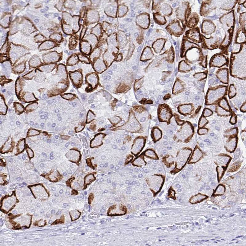 Immunohistochemistry: Aquaporin-4 Antibody (CL0178) [NBP3-52095]