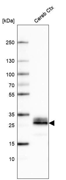 Western Blot: Aquaporin-4 Antibody (CL0178) [NBP3-52095]