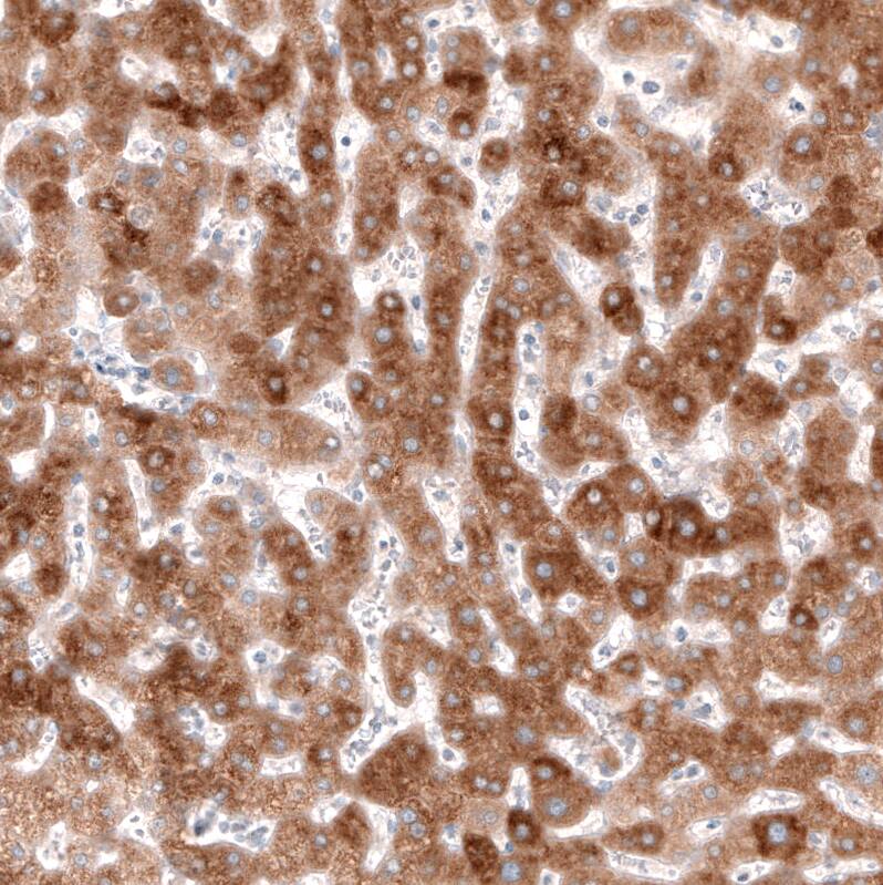 HMG-CoA Reductase/HMGCR Antibody (CL0260) Immunohistochemistry: HMG-CoA Reductase/HMGCR Antibody (CL0260) [NBP3-52096]