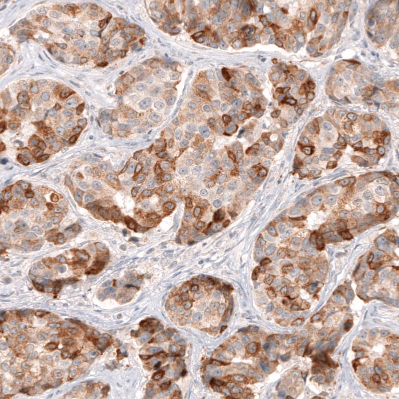 HMG-CoA Reductase/HMGCR Antibody (CL0260) Immunohistochemistry: HMG-CoA Reductase/HMGCR Antibody (CL0260) [NBP3-52096]